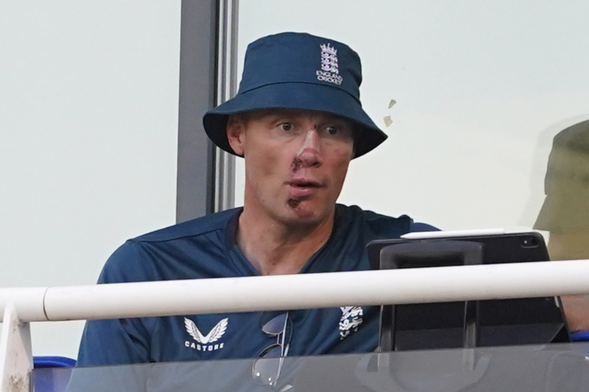 Freddie Flintoff has facial injuries after Top Gear crash | Wilts and Gloucestershire Standard - Vimarsana News